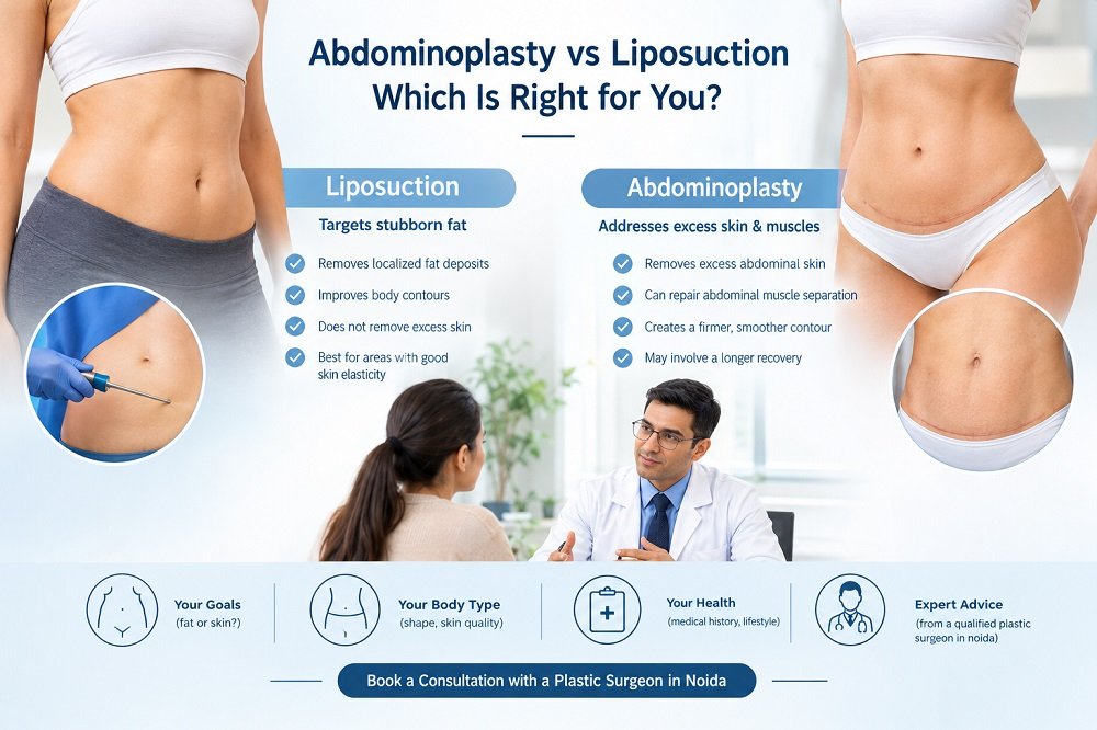 Plastic Surgeon in Noida
